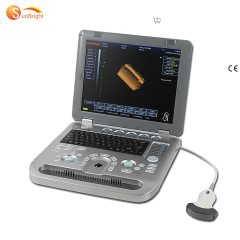 China 3d Portable laptop color diagnostic system echography pregnancy scanner medical ultrasound machine price China 3d Portable laptop color diagnostic system echography pregnancy scanner medical ultrasound machine price