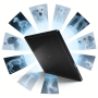 Affordable 17x17" Veterinary X-ray Detector, High Cost-Effective Pet X-ray Flat Panel Wired X-ray Detector