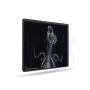 17*17 inch large flat panel detector, DR X-ray detector wired