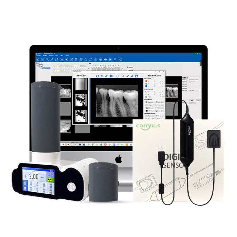 Dental Portable X-Ray Machine Digital Sensor Limited Time Sale