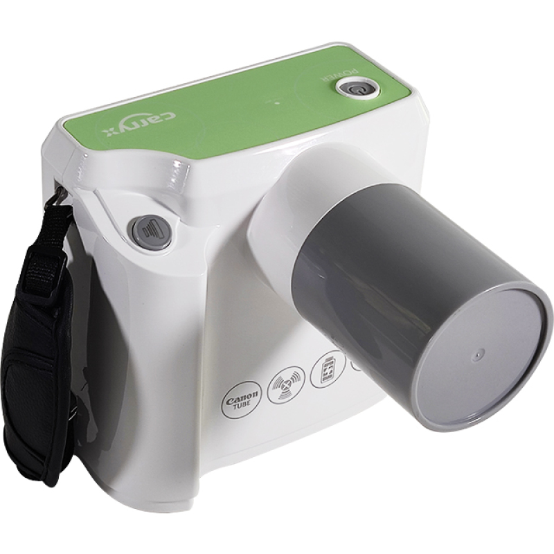 Manufacturer 0.4mm Focus Spot New Digital Portable X Ray Dental Machine