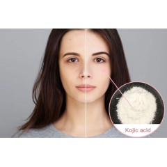 Supply Cosmetic materials- Kojic Acid Kojic Acid Powder