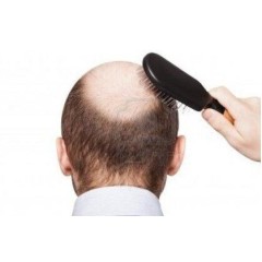 US Drop shipping Hair growth products  CB-03-01
