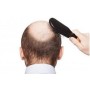 US Drop shipping Hair growth products  CB-03-01