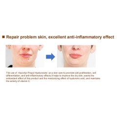 New Cosmetic Raw Materials Ascorbyl Propyl Hyaluronate CAS.1800464-57-6