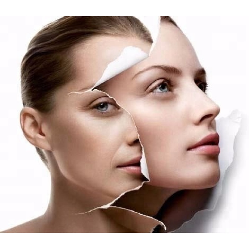 Acetyl Octapeptide-3 Cosmetic Beauty Snap-8 CAS:868844-74-0