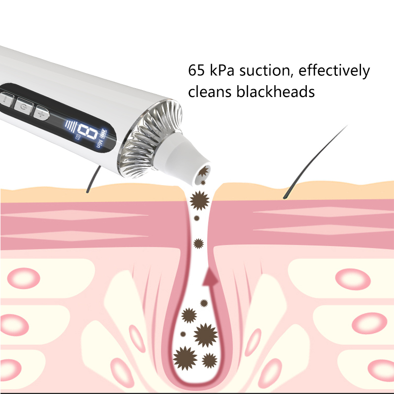 Blackhead And Acne Removing Instrument,Blackhead Suction Instrument