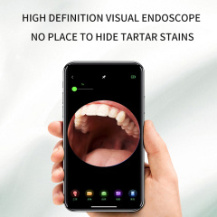 Portable Electric Home Smart Visual Electric Ultrasonic Teeth Cleaner