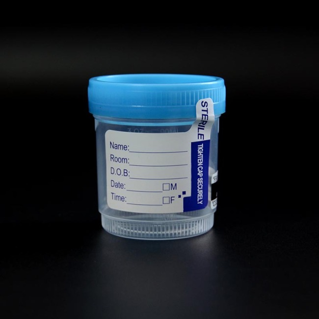 Vasos para muestras de orina de 90 ml con tapón de rosca azul