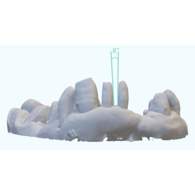 CAD CAM Exocad Design 3D Escáner dental Impresión Escaneo dental Velocidad rápida Escáner portátil 3D Dental