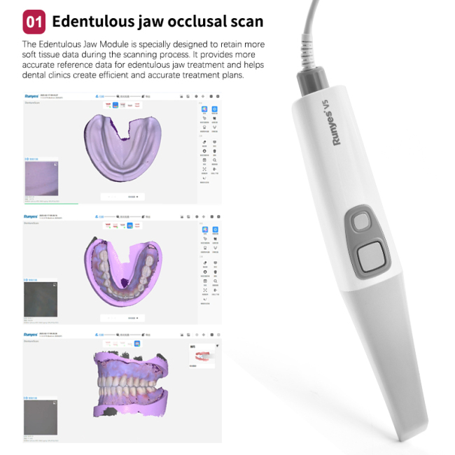 Runyes 3D-Intraoralscanner V5, V5pro Mini-Intraoralscanner