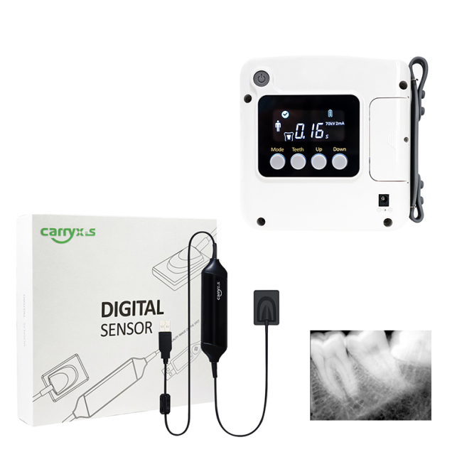 2023 Lowest Price Dental Portable X-ray Machine Digital Sensor Big sale