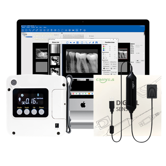 2023 Lowest Price Dental Portable X-ray Machine Digital Sensor Big sale