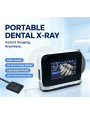 Portable Dental Xray System With AI Diagnosis All in One Dental XRay Unit Real Time Image Display Wireless Charging DentalSensor
