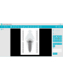 Perro gato sensor digital dental para mascotas