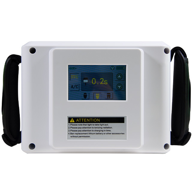 Radiografía dental digital inalámbrica portátil de la pantalla táctil