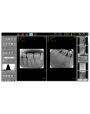 Escáner de película de rayos X de placa de imagen intraoral digitalizada dental