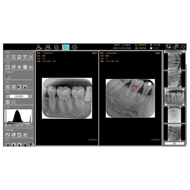 Escáner de película de rayos X de placa de imagen intraoral digitalizada dental