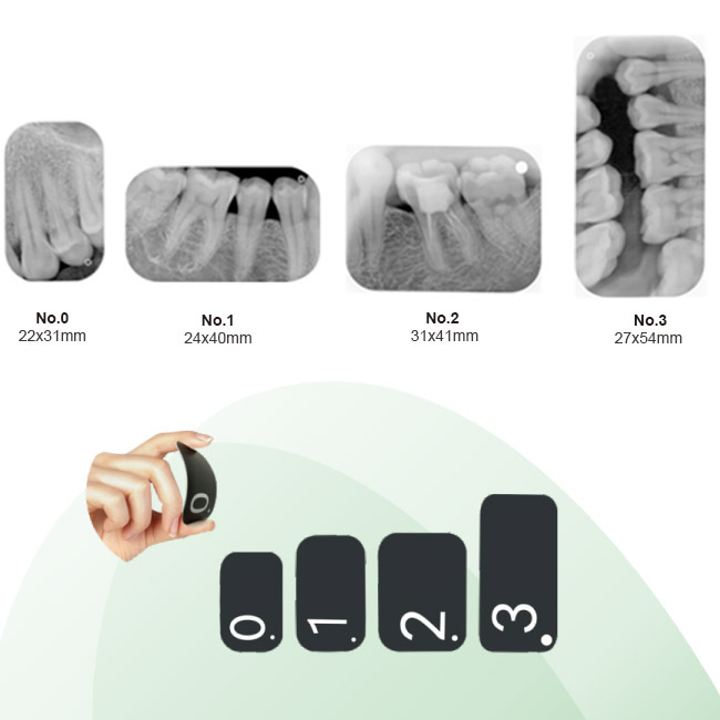 Escáner de película de rayos X de placa de imagen intraoral digitalizada dental