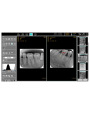 Dental Digitalized intraoral Imaging Plate X ray Film Scanner