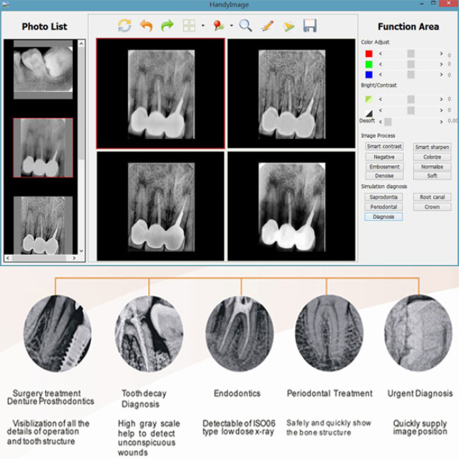 Sistema dental de Digitaces del sensor USB de la radiografía dental de China