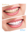 Máquina para blanquear los dientes LED Light 8 Bombilla Strong Power