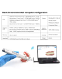 Wireless Portable Run_yes 3DS V6 AI Intraoral Scanner, WiFi Connection 25mm Depth Digital Dental Equipment