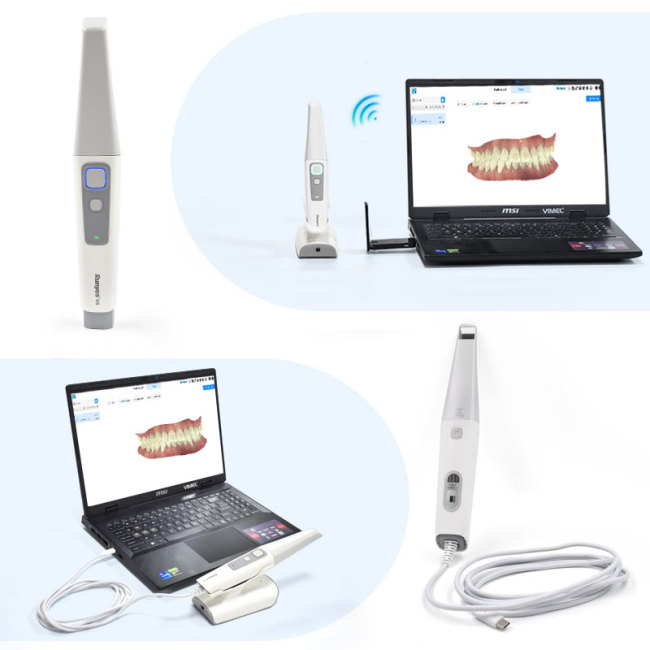 Kabelloser, tragbarer Run_yes 3DS V6 AI Intraoralscanner, WLAN-Verbindung, 25 mm Eindringtiefe, digitales Dentalgerät